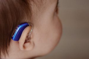 Aparelho Auditivo Pediatrico Viva Bem Aparelhos Auditivos